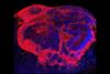  مغزهای کوچک آزمایشگاهی، سرنخ‌هایی را در مورد آغاز اسکیزوفرنی آشکار می‌کنند