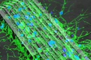 میکروربات‌هایی که اتصال میان سلول‌های عصبی را برقرار می‌کنند