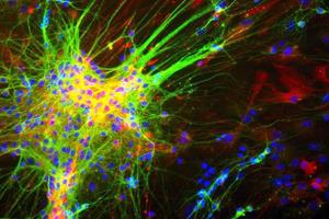 رشد نورون‌ها در ناحیه‌ای از مغز از 13 سالگی متوقف می‌شود