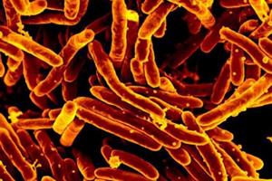 بررسی حمله باکتری‌های سل به آنتی‌بیوتیک‌ها 