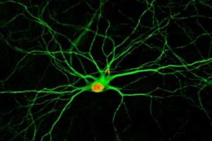  ترمیم آسیب‌های مغزی با تبدیل سلول‌ها به نورون‌های جدید