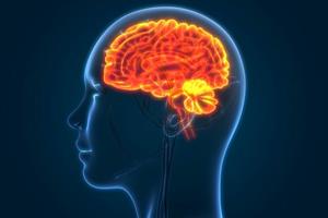 درمان تورم مغز پس از سکته با کمک ژن‌درمانی