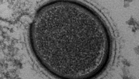 کشف یک ویروس 30 هزار ساله در سیبری 