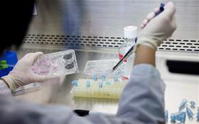 کشف داروهای بالقوه جدید برای درمان سرطان در آزمایشگاه 