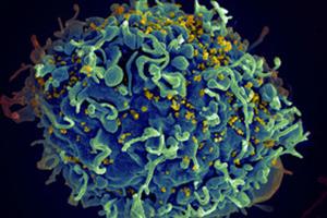 کشف گونه جدید ویروس اچ‌آی‌وی با قابلیت تبدیل شدن به ایدز ظرف سه سال 