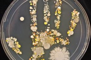 تصاویری جالب از میکروب‌های کف دست کودک یک میکروب‌شناس 