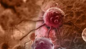 کشف سوئیچ کنترل رشد سلول سرطانی  