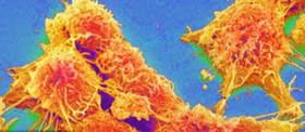 گرمادرمانی تومورها با نانوذرات و امواج ماکروویو 