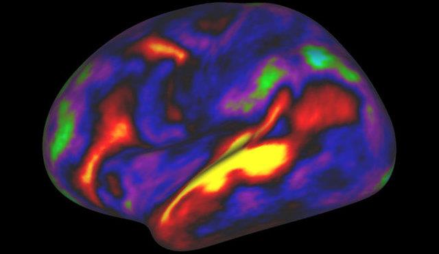 کشف 100 قسمت ناشناخته و جدید در مغز 