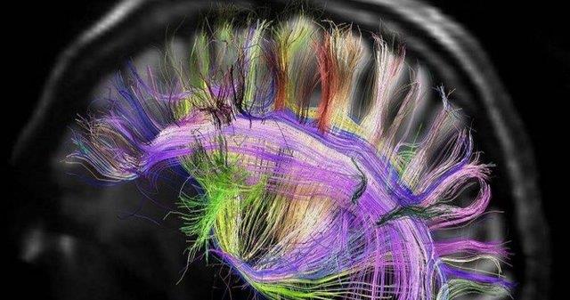 بهبود ظرفیت حافظه صوتی مغز با نیروی مغناطیسی