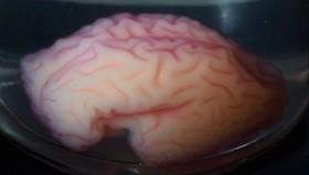 دانشمندان موفق به مدل‌سازی شیارهای مغز شدند 
