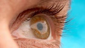 تنبلی چشم باعث تغییر سیم‌کشی مغز می‌شود 
