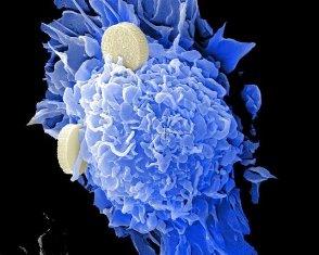 مهار متاستاز سرطان روده بزرگ با کمک یک مولکول کوچک