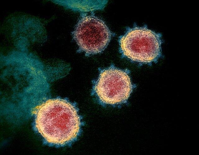  پروتئین‌هایی که مانع ورود کروناویروس به سلول‌های انسان می‌شوند