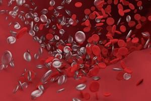 ابداع یک روش غیرتهاجمی برای شناسایی لخته خون در قلب