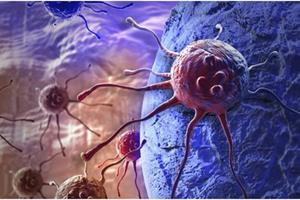 سوندی برای شناسایی سریع سلول‌های سرطانی