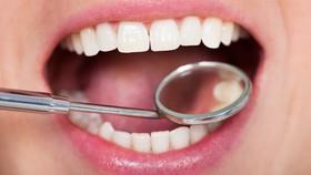 ترمیم بهتر کانال دندان با نانوذرات الماس ترکیب شده با مواد پرکننده 