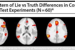 استفاده از اسکن مغزی برای تشخیص دروغگویی