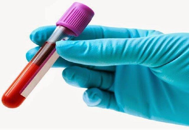  ابداع یک آزمایش خون دقیق‌تر برای بررسی ناهنجاری‌های ژنتیکی جنین