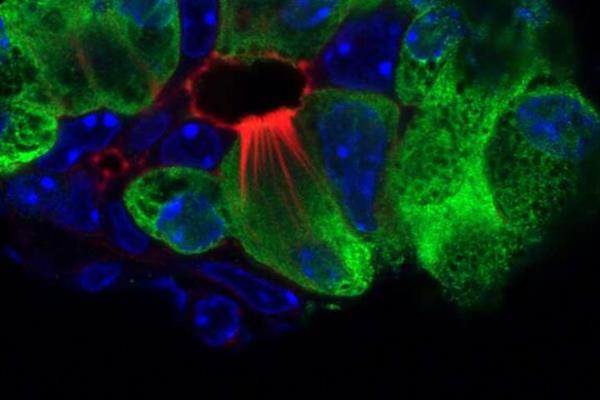 سلول‌هایی که می‌توانند به درمان سرطان پانکراس کمک کنند