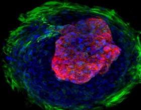 موفقیت دانشمندان در رشد دادن بافت قلبی تپنده با سلول‌های بنیادی 