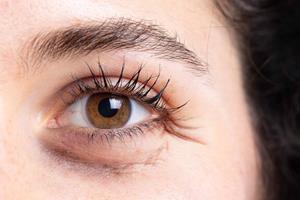  تعیین سن زیستی با اسکنر چشم