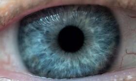  پیش‌بینی زودهنگام بیماری چشمی با یک آزمایش مبتنی بر هوش مصنوعی