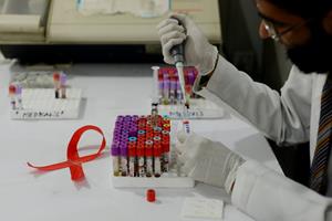 درمان اچ.آی.وی نزدیک است