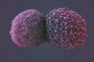 فناوری نانو به جنگ سلول‌های سرطانی می‌آید