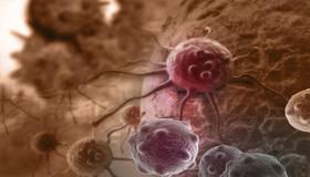 ترکیب نانوماسک و پرتودرمانی برای درمان سرطان 