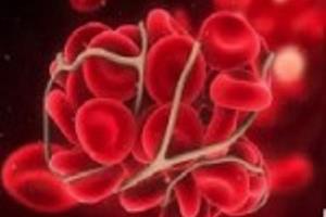 تاثیر مثبت نانوداروی ضدانعقاد خون برروی موش های آزمایشگاهی