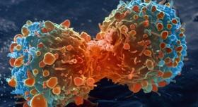 نانوبمب‌های نابودکننده سلول‌های سرطانی 