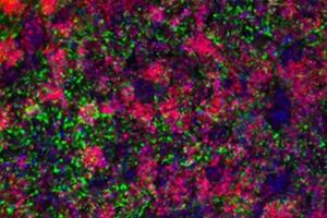 تولید نورون‌های کنترل‌کننده اشتها از سلول‌های پوست 