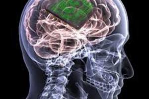 افزایش قدرت حافظه با ایمپلنت‌های مغزی 