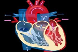 الیاف نانولوله کربنی برای درمان نارسایی الکتریکی قلب