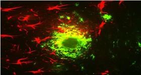 بازیابی حافظه موش‌های آلزایمری با داروی سرطان 