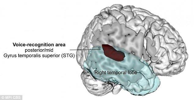 دانشمندان بخش مسئول تشخیص صداها در مغز را پیدا کردند