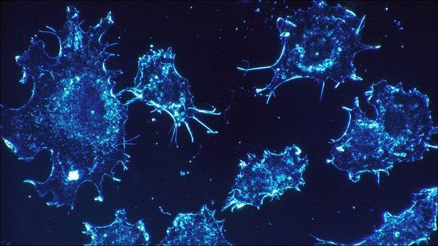 سلول‌های سرطانی ساعت بدن را تغییر می‌دهند
