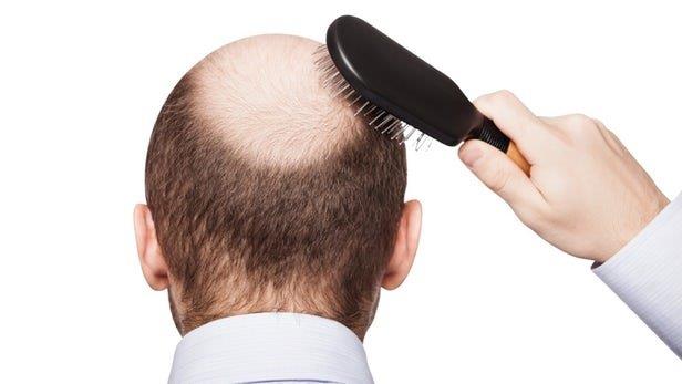 رشد دوباره مو با استفاده از عوارض جانبی یک داروی قدیمی