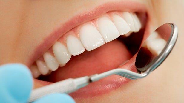 سیستم ایمنی بدن می‌تواند باعث پوسیدگی دندان شود
