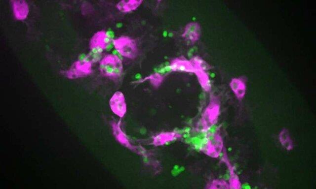 سلول‌های مرده می‌توانند عملکرد سیستم ایمنی را مختل کنند