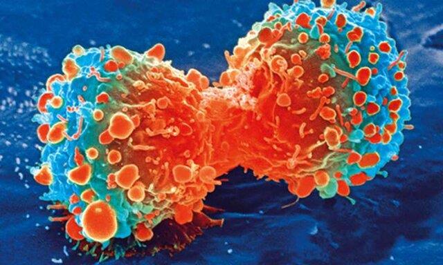 روش جدیدی که می‌تواند سرطان را در مراحل ابتدایی شناسایی کند