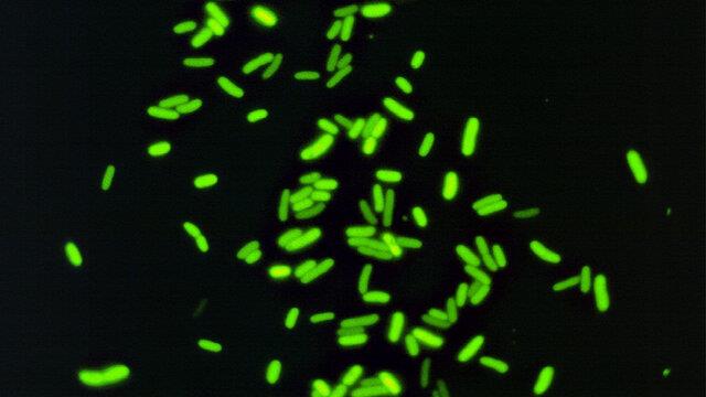 ابزاری که باکتری‌های مقاوم در برابر دارو را شناسایی می‌کند