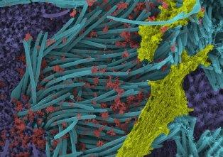 تصاویر سلول‌های آلوده به "کروناویروس سندرم حاد تنفسی ۲" منتشر شد