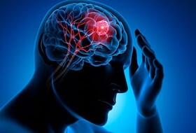 تشخیص تومور مغزی از طریق آزمایش ادرار یا پلاسمای خون