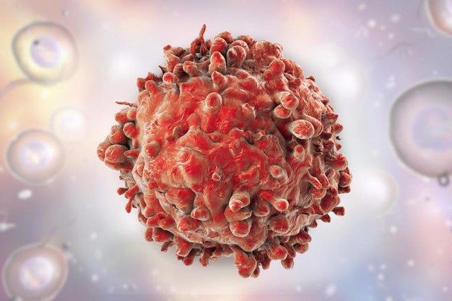  درمان بدون عارضه سرطان لوزالمعده با نانوحامل‌های پروتئینی