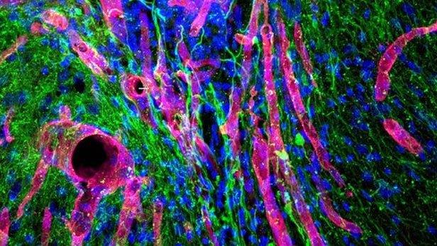 ایجاد بافت جدید در مغز با یک هیدروژل قابل تزریق