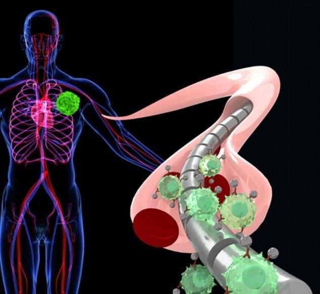 تشخیص دقیق‌ سرطان با یک سیم مغناطیسی