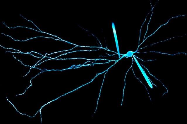 جداسازی نورون‌ها بر قدرت محاسباتی مغز موثر است