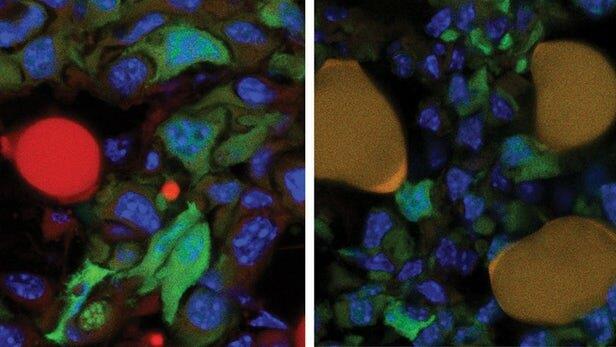  جلوگیری از تکثیر سلول‌های سرطانی با تبدیل آنها به چربی
